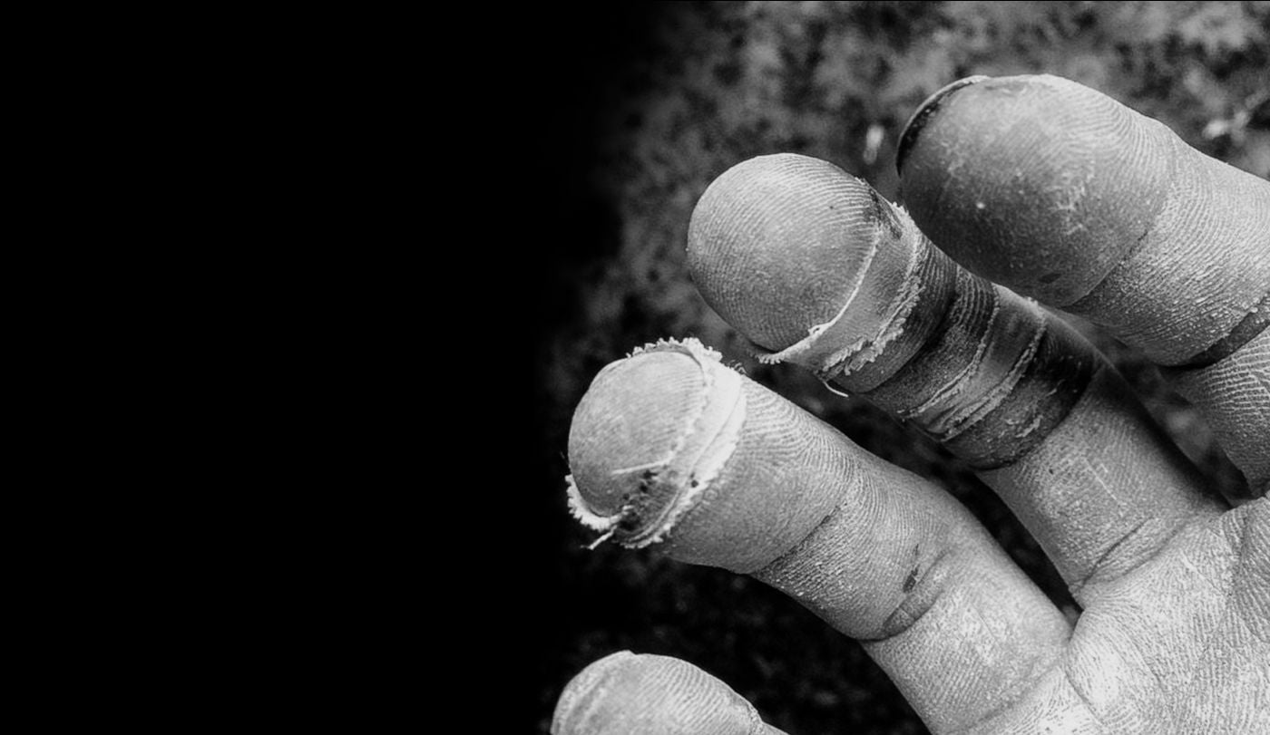 Finger Injuries and Treatment | Training and Skills